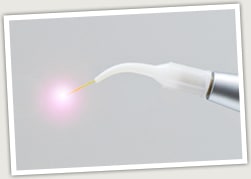 レーザー治療の導入